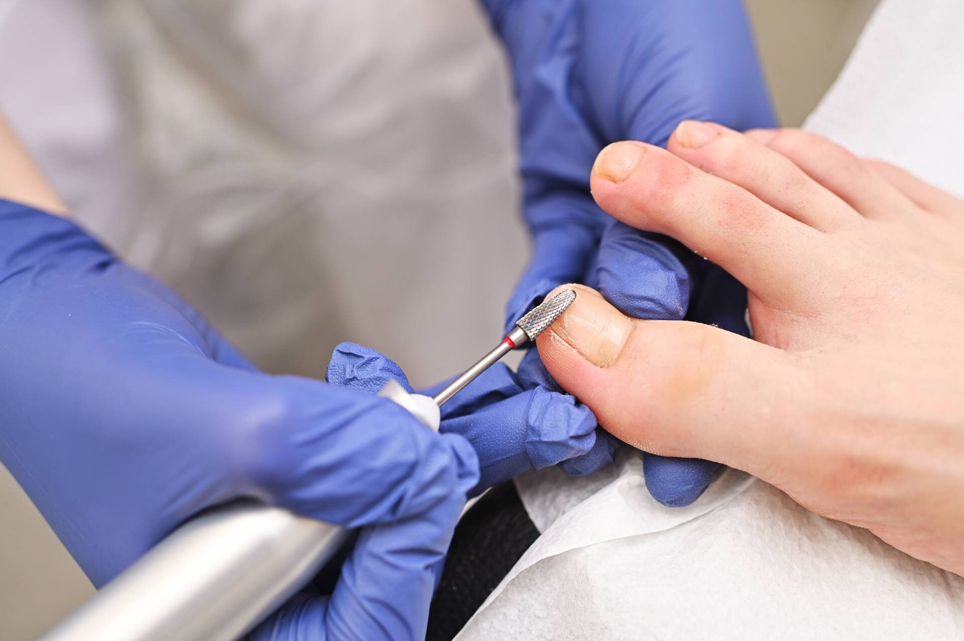 hardware-medical-pedicure-with-a-drill-and-nail-fi